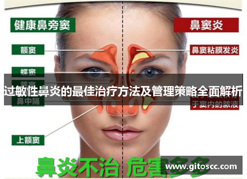 过敏性鼻炎的最佳治疗方法及管理策略全面解析